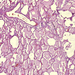 oedema pulmonis1